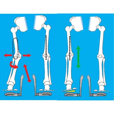 Syndrome de la bandelette ilio-tibiale en cyclisme — illustration 1